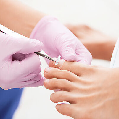 Fachfußpflege - spangentechnik